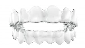 How much do clear braces cost in the UK